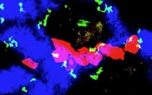 Phát hiện đột phá: Cơ chế giúp bệnh ung thư tự "ngủ đông"