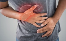 Hãy để ý: Nếu có dấu hiệu “3 đen 2 hôi” trên cơ thể thì có thể bạn đã mắc các bệnh về gan cần đi khám gấp