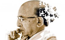 Alzheimer sẽ là cơn ác mộng khi về già, trừ khi bạn thực hiện 5 thói quen ăn uống cực kỳ đơn giản này ngay từ bây giờ
