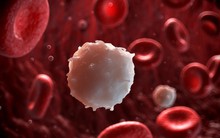 Sự thật về phương pháp chữa ung thư tốn tiền tỷ, được quảng cáo ức chế 80% tế bào ung thư