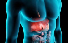 Dấu hiệu thay đổi trên da cho thấy bạn đã bị bệnh gan: Nếu trùng khớp thì nên đi khám ngay