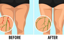 6 bài tập đơn giản có tác dụng lưu thông hệ bạch huyết, giúp giảm cân không cần ăn kiêng