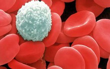 Căn bệnh nhầm tưởng sốt virus giết chết 3 người ở Hà Tĩnh thực chất là bệnh gì?