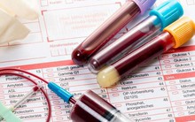 7 căn bệnh phải đi khám sớm ngay khi bước vào tuổi trung niên: Đừng chần chừ kẻo hối hận cả đời!