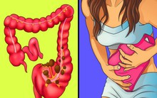 7 cách để đồng thời giảm đau dạ dày và ngăn ngừa táo bón