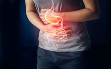 Bỏ qua những dấu hiệu này chắc chắn dạ dày của bạn phải chịu hậu quả nặng nề