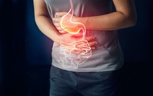 8 dấu hiệu ung thư dạ dày bạn không nên bỏ qua: "Tử thần" này hoàn toàn có thể ngăn chặn nếu được phát hiện kịp thời