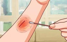 Tưởng bình thường nhưng hóa ra đây đều là những biểu hiện cảnh báo ung thư đang phát triển trong cơ thể bạn