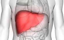 8 dấu hiệu cảnh báo bệnh gan: Nếu có triệu chứng là bạn cần đến bác sĩ càng sớm càng tốt