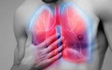 4 loại thực phẩm "vàng" tốt nhất cho phổi: Người có bệnh thì nên ăn nhiều để giảm viêm