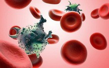 Làm việc này 5 lần/tuần để giảm nguy cơ mắc 13 loại ung thư, đặc biệt là ung thư gan