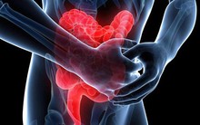 5 dấu hiệu của bệnh viêm trực tràng: Không điều trị sẽ có nguy cơ tiến triển thành ung thư