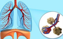 Ai quan tâm đến sức khoẻ tim, gan, phổi, thận cần phải biết điều này