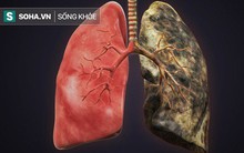 Bệnh về phổi ngày càng phổ biến: Hãy ăn những thực phẩm này để ngăn ngừa bệnh "tấn công"