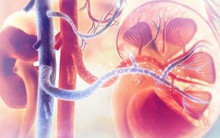 3 dấu hiệu cảnh báo bệnh thận viêm, đừng để tiến triển thành suy thận bạn mới hoảng sợ
