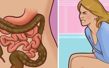 Báo động ung thư đại trực tràng trẻ hoá, 12 tuổi đã mắc: Có dấu hiệu này cần khám ngay