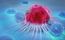 Ăn thường xuyên những loại thực phẩm này, bạn dễ bị ung thư