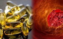 Nghiên cứu chứng minh: Dầu cá chính là loại thực phẩm giúp kiểm soát cholesterol vô cùng hiệu quả