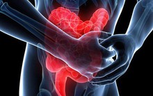 Khi đại trực tràng gửi đến bạn 5 tín hiệu này: Hãy cẩn thận đi kiểm tra ung thư ngay