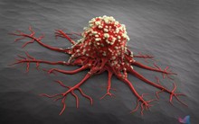 Ai cũng sợ mắc ung thư nhưng tế bào ung thư lại rất "sợ" nếu bạn đều đặn làm 7 việc này mỗi ngày