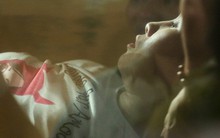 Nữ CĐV bị bỏng nặng vì trúng pháo: Vết nhơ của bóng đá Việt Nam