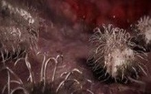 Hiểu đúng và phòng ngừa "vi khuẩn ăn thịt người"