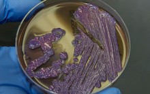 Mọi thông tin về căn bệnh "nhiễm khuẩn ăn thịt người" - Whitmore, đặc biệt là cách phòng ngừa cần lưu ý