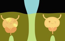 5 dấu hiệu ung thư sớm thường bị quý ông bỏ qua: Phát hiện muộn có thể không còn cơ hội