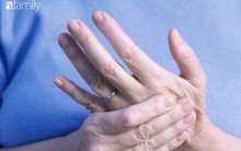 Bạn nên đến bác sĩ nếu gặp phải những dấu hiệu về khớp này trong cuộc sống hàng ngày