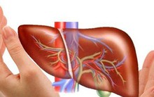 Gan chỉ có 1 lá rất dễ tổn thương: 6 việc cần làm ngay giúp "dưỡng gan"