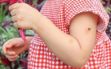 Số ca mắc sốt xuất huyết gia tăng và có xu hướng nặng: Cảnh báo chu kỳ của đỉnh dịch vào tháng 10 và 11