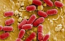 Báo cáo của CDC tuyên bố: Nước Mỹ đã bước vào thời kỳ hậu kháng sinh