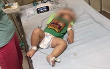 Giới chuyên gia khẳng định: Whitmore không lây truyền từ người sang người như nhiều người đang bàn tán