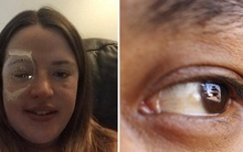 Thấy nhiều đốm trắng nhấp nháy trong phòng ngủ, cô gái người Anh đi khám và không ngờ mình đã bị ung thư mắt