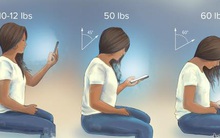 Người Việt nào cũng đeo 30kg vật nặng lên cổ 2h mỗi ngày vì làm việc quen thuộc này