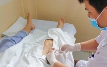 Căn bệnh mà nhân viên kế toán, dân văn phòng thường mắc do ngồi nhiều, ít vận động: Đây là lời cảnh báo từ bác sĩ!