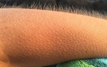 Dù mặc kín bưng nhưng vẫn luôn cảm thấy lạnh run người: Dấu hiệu cảnh báo các vấn đề sức khoẻ bạn nên chú ý