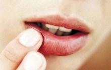 Bỗng dưng thấy răng miệng xuất hiện thứ này, đừng bỏ qua bởi có thể tim, gan, thận của bạn có thể đang gặp nguy hiểm!