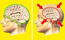 Não bộ sẽ co lại nếu tình trạng căng thẳng xảy ra thường xuyên, may mắn thay, đây là chìa khóa dành cho bạn!