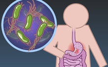 6 nhóm người có nguy cơ cao mắc bệnh ung thư dạ dày, cần chủ động đi nội soi ngay từ sớm