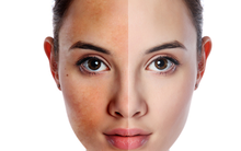 Da mặt bỗng chuyển đỏ hoặc vàng bất thường nghĩa là nội tạng của bạn đang "cầu cứu"