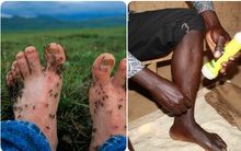 Nghề câu... muỗi kỳ lạ: Những người lấy chính cặp giò làm mồi nhử, ai cũng bất ngờ khi phát hiện lý do cao đẹp phía sau