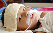 Bắt đầu vào mùa viêm não Nhật Bản, cha mẹ cần phân biệt triệu chứng sốt do viêm não Nhật Bản và bệnh lý khác để phòng bệnh cho con