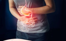 Bất luận nam hay nữ, nếu cơ thể xuất hiện "2 đau - 1 nhiều" cần lập tức đi khám đề phòng ung thư ruột