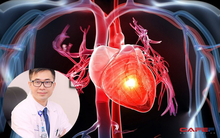 10 triệu chứng tưởng đơn giản nhưng là cảnh báo nghiêm trọng của bệnh tim, thận và phổi: Càng chủ quan hậu quả càng đáng tiếc