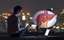 Người đàn ông 35 tuổi nhận thấy 2 dấu hiệu bất thường trên cơ thể, gặp bác sĩ thì bệnh xơ gan đã ở giai đoạn cuối: Đừng vì bận rộn mà bỏ quên tài sản quý giá nhất!