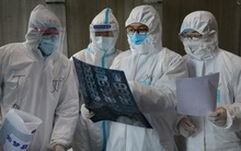 Không chỉ ho, sốt, khó thở, WHO còn liệt kê thêm những "tín hiệu" đặc biệt khác của COVID-19, khuyến cáo người dân không được chủ quan