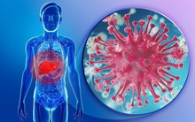 Phòng hơn chống, hãy khôn ngoan TỰ CỨU MÌNH bằng 9 nguyên tắc ‘vàng’ đẩy lùi ung thư