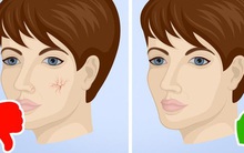 Những dấu hiệu cảnh báo gan bị tổn thương, cần đi khám bác sĩ ngay