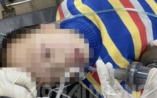 Bệnh nhi người Trung Quốc nghi nhiễm virus corona, nhiều nhân viên y tế ở Hải Dương phải theo dõi sức khoẻ